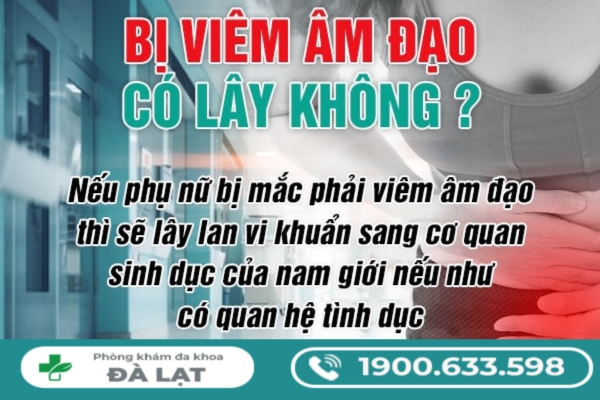 Hình ảnh minh họa